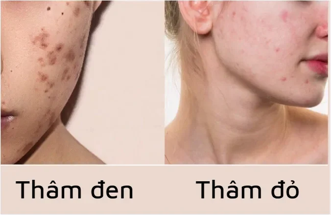 Làm Sạch Da 2 Lần Mỗi Ngày – “Chìa Khóa” Vàng
