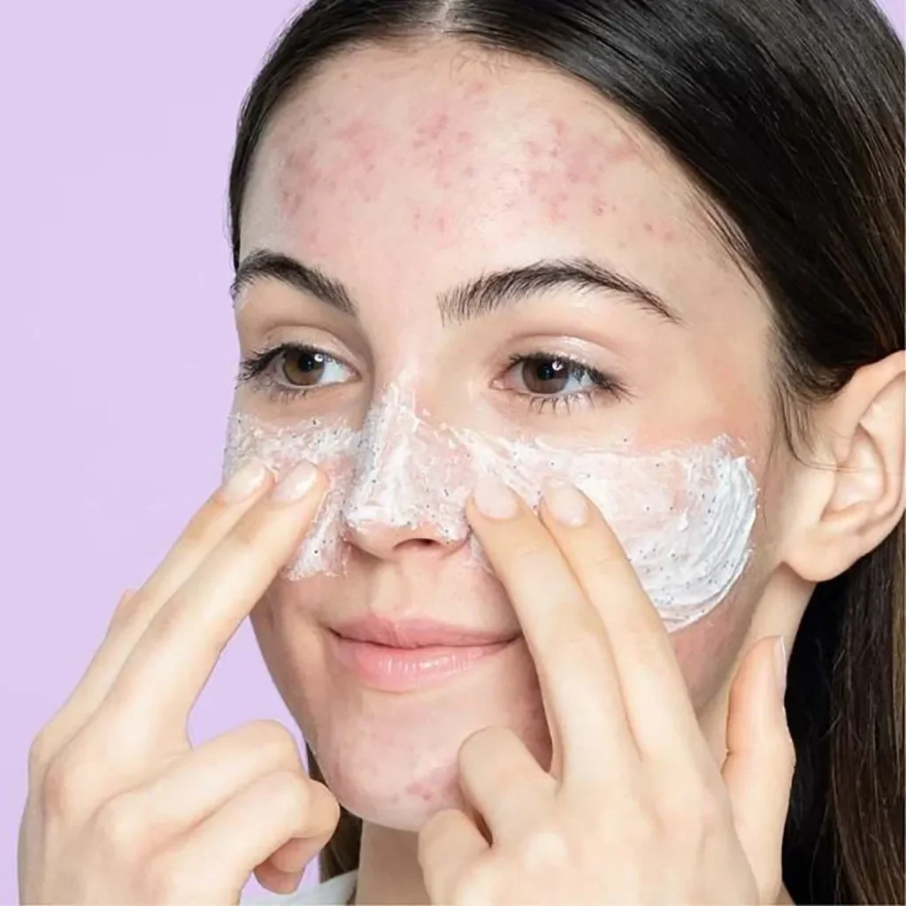 Top 7 sữa rửa mặt cho da mụn “đỉnh của chóp” được yêu thích nhất hiện nay